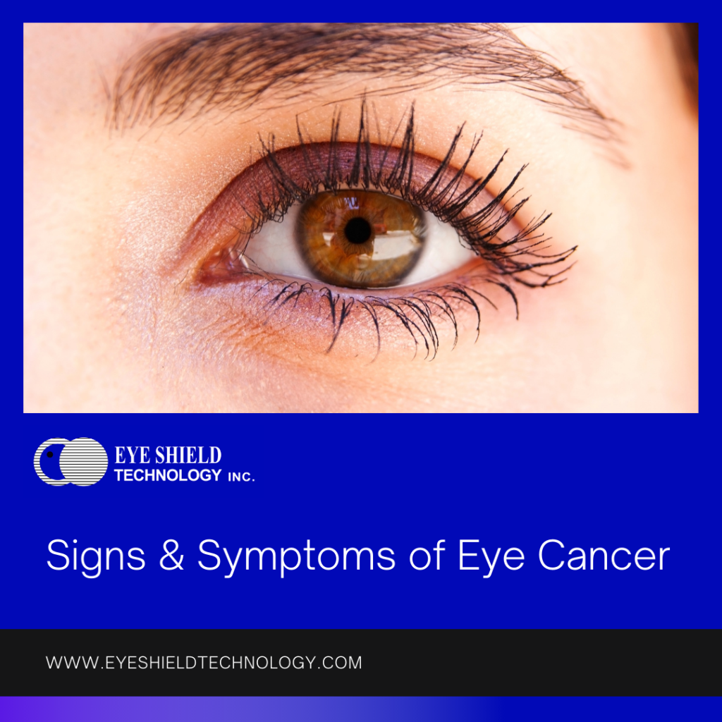 Signs Symptoms Of Eye Cancer Eye Shield Technology